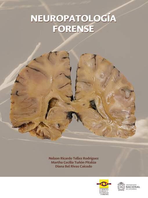 Title details for Neuropatología forense by Nelson Ricardo Tellez - Wait list